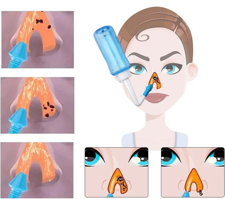 HOUDIAN Neti Pot Nasendusche für Kinder und Erwachsene 2 Aufsätze 300 ml
