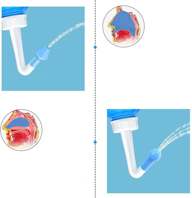 HOUDIAN Neti Pot Nasendusche für Kinder und Erwachsene 2 Aufsätze 300 ml